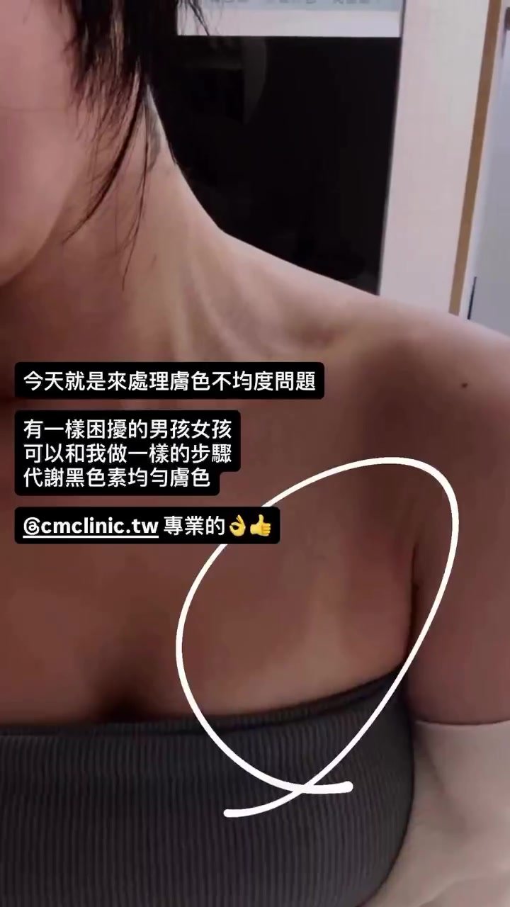 王小月美白點滴療程分享 封面